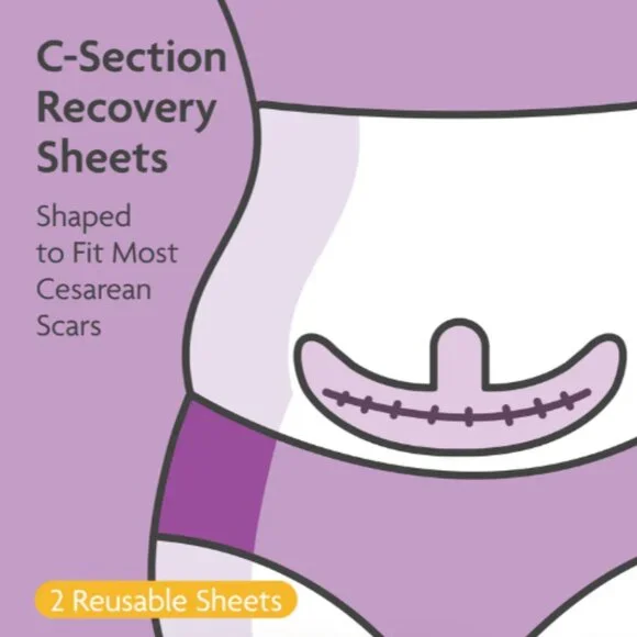 TriLASTIN C-Section Scar Sheet - Anchor - Picture 3 of 4